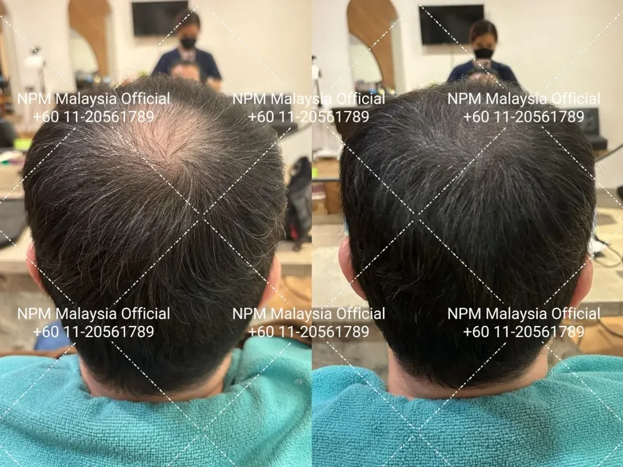 Before / after · shared with client permission