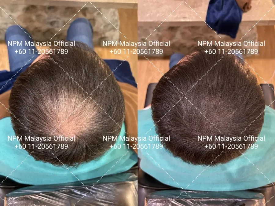 Before / after · shared with client permission