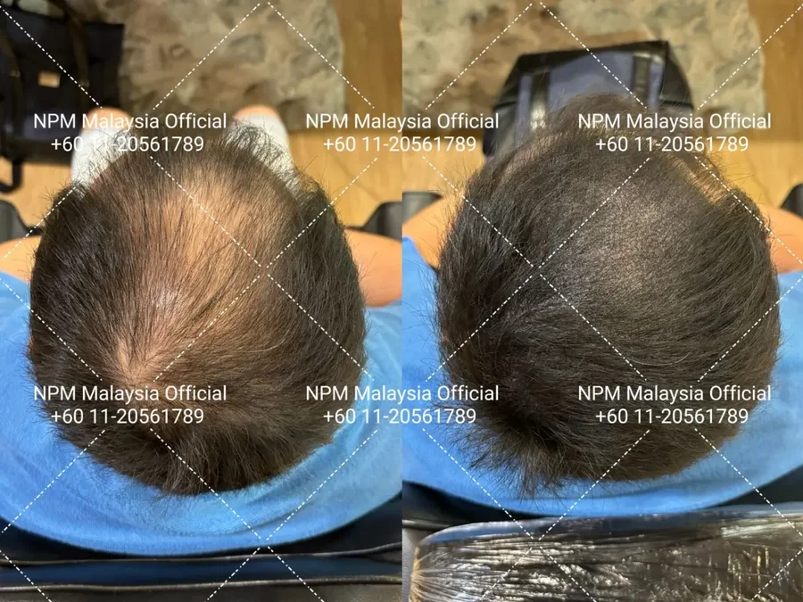 Before / after · shared with client permission