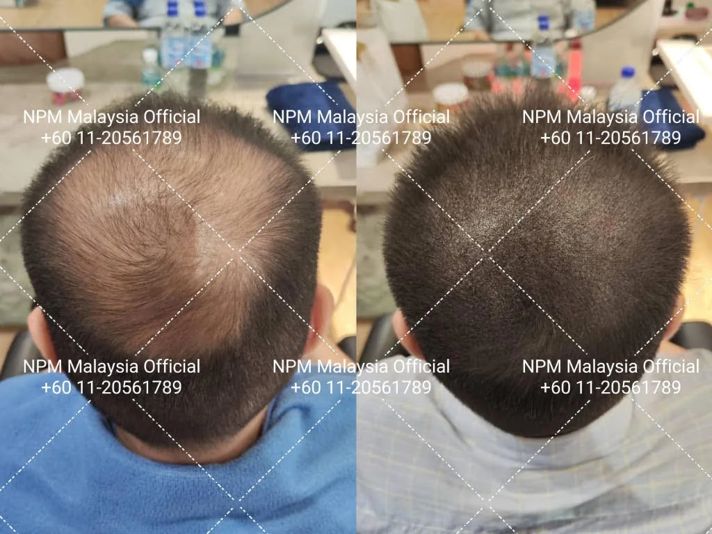 Pudar dan sentuhan semula: merancang SMP jangka panjang
